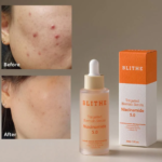 BLITHE TARGETED BLEMISH SERUM NIACINAMIDE 5.0 30ML serum rozjaśniajace