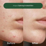 BLITHE ANTI-POLLUAGING PORE CLEANSING FOAM BHA Tea Tree 150ML oczyszczająca pianka do twarzy